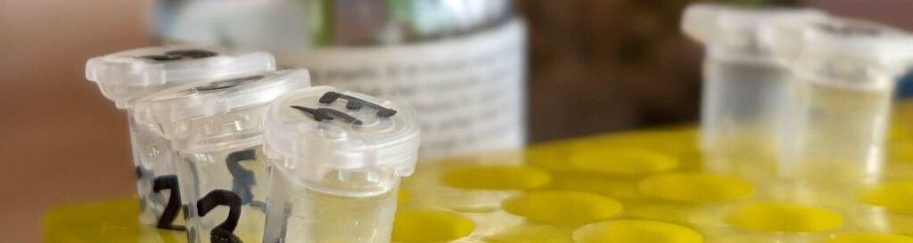 Some test tubes sit in a yellow tray, they are used for identifying plant DNA